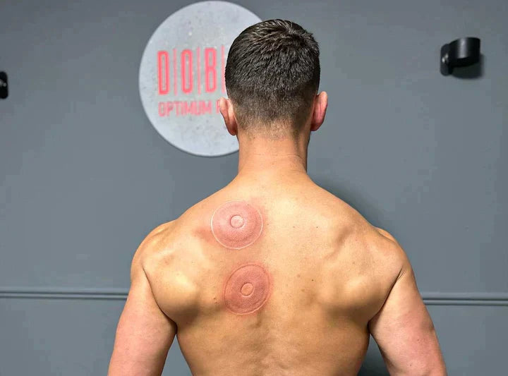 Smart Cupping Therapy Device - Red Light Heat Therapy with LCD Display