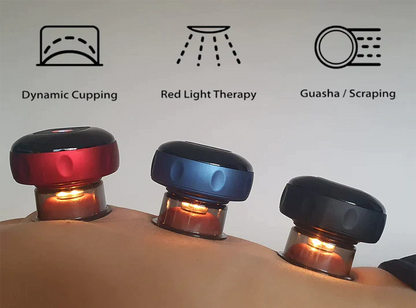 Smart Cupping Therapy Device - Red Light Heat Therapy with LCD Display